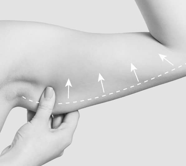 Arm of young woman after slimming on light background. Plastic surgery concept